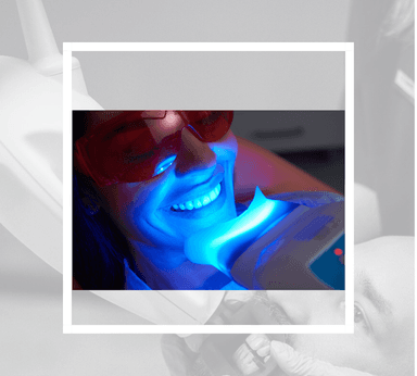 Diş Beyazlatma (Lazer diş beyazlatma, avantajları, ne için yapılır)