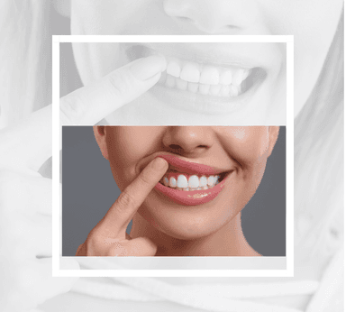 Periodontoloji (Detertraj, küretaj, lazer diş eti tedavisi, diş eti cerrahisi, gummy smile düzeltme)